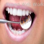 Best Teeth Whitening Treatment | Aspen Dentals
